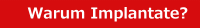 Warum Implantate sinnvoll sind